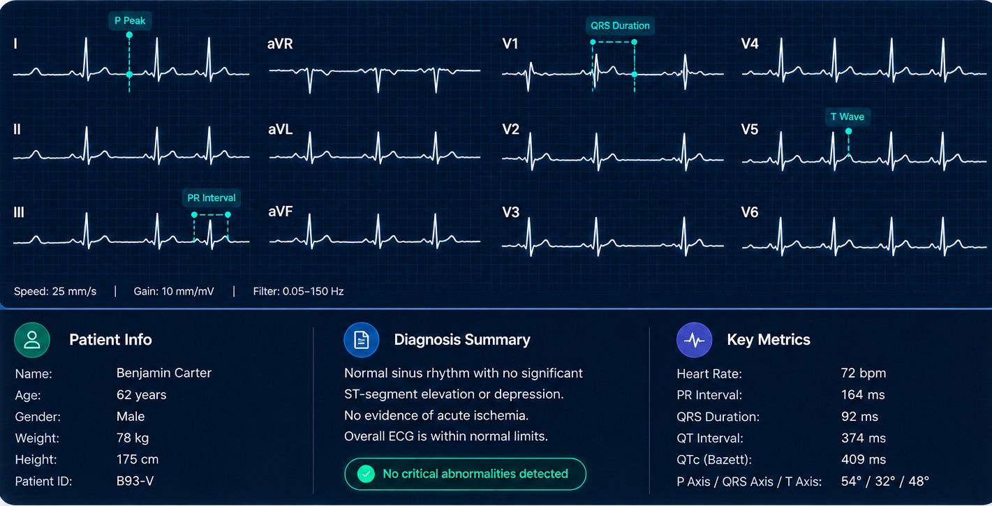 ECG waveform visualization from the NCEP project repository